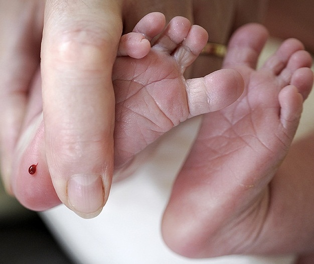 Sàng lọc sơ sinh ở Việt Nam đang được đẩy mạnh 
