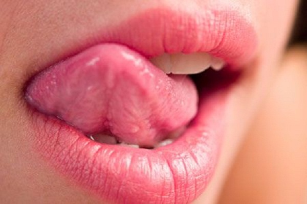 Điều trị bệnh viêm lưỡi kéo dài như thế nào?