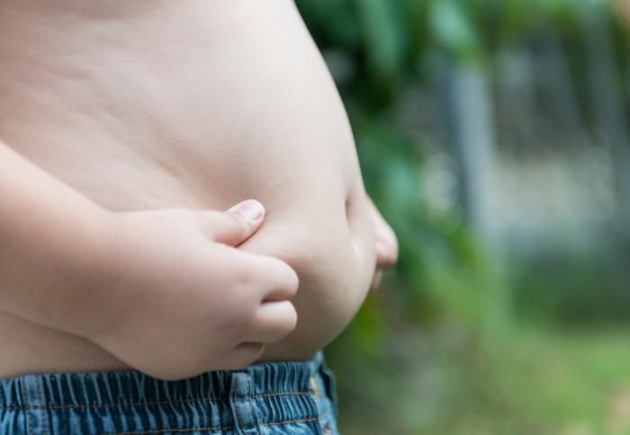 Nhiều phụ huynh không nhận ra con thừa cân béo phì