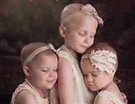 Bộ ảnh về ba bé gái ung thư đẹp như thiên thần