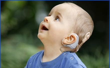 Cấy điện cực ốc tai, 80 trẻ cải thiện chức năng nghe, nói