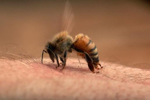 Sơ cứu nhanh khi bị ong đốt