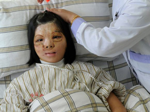 Trung Quốc: Ghép khuôn mặt mới được nuôi cấy từ ngực
