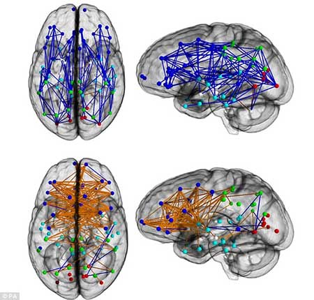 Bằng chứng về khác biệt não bộ giữa nam và nữ