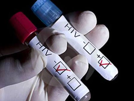 HIV không quá đáng sợ!