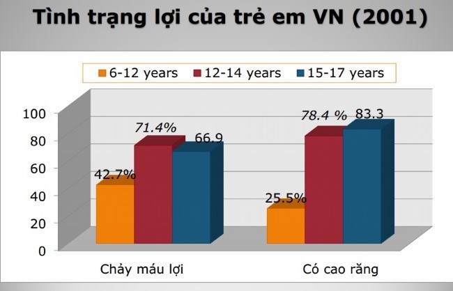 90% người Việt mắc bệnh nha chu