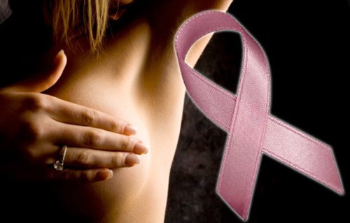ung thư vú: 90% chữa khỏi