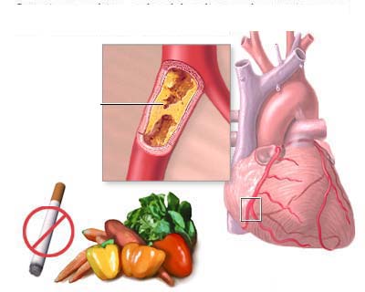 TPCN có phòng được bệnh tim mạch?
