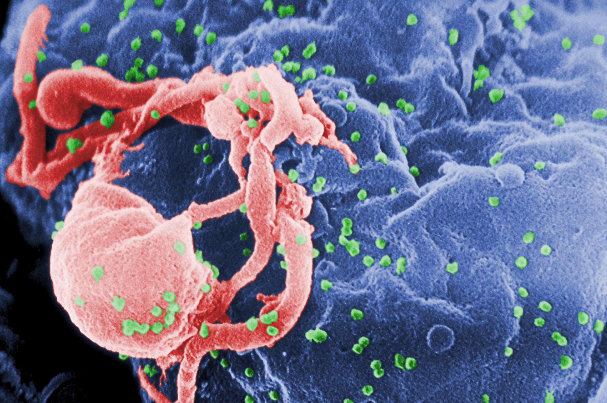 TPCN ngăn ngừa sự phát triển của HIV