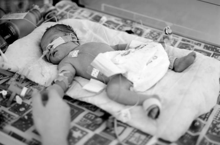 Bú sữa mẹ - Trẻ sinh non giảm nguy cơ viêm ruột hoại tử 