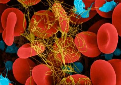 Phát hiện ký sinh trùng trong máu bằng smartphone