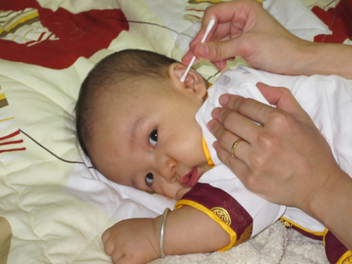 Dùng tăm bông ngoáy tai cho trẻ sơ sinh: Hậu quả khôn lường