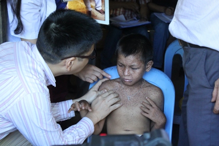Bệnh da ở Phú Thọ: Không phải bệnh lạ, là bệnh khô da sắc tố