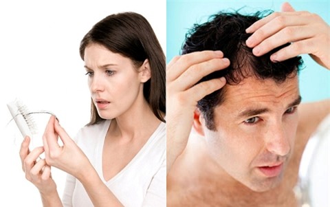 Sau nhiều năm nghiên cứu, giới khoa học toàn cầu đã xác định nguyên nhân chính gây rụng tóc ở nam và nữ là khác nhau.
