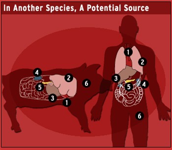 Giới khoa học đang hướng tới nguồn nội tạng cấy ghép cho người từ heo. Ảnh: CBS NEWS