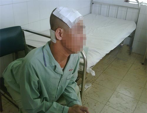Ca phẫu thuật đặt điện cực điều trị bệnh Parkinson tại Bệnh viện Nguyễn Tri Phương Ca phẫu thuật đặt điện cực điều trị bệnh Parkinson tại Bệnh viện Nguyễn Tri Phương