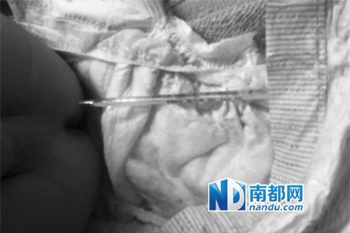 Bé 18 tháng bị quên nhiệt kế trong hậu môn - 1