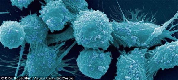 Phát hiện về cách phòng ngừa ung thư ung thư tuyến tiền liệt ở nam giới 1