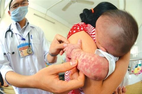Không thể “từ chức” khi toàn ngành y tế đang tập trung cao độ cho công tác phòng chống dịch bệnh