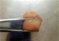 quả vải gây ra cái chết thương tâm cho bé trai 6 tuổi