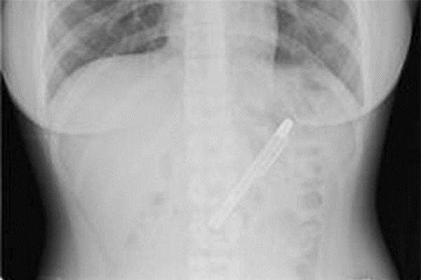pen1-8073-1404698950.jpg