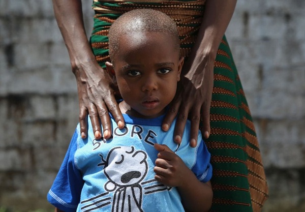 Ebola: Chân dung những người may mắn sống sót - Ảnh 7
