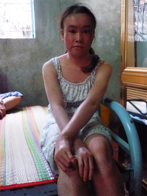 2014: 6 căn bệnh kỳ lạ nhất Việt Nam - Ảnh 8