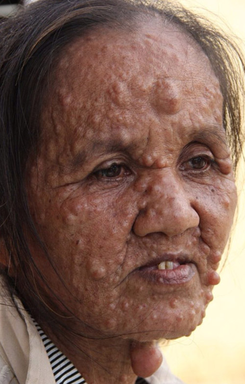 2014: 6 căn bệnh kỳ lạ nhất Việt Nam - Ảnh 4