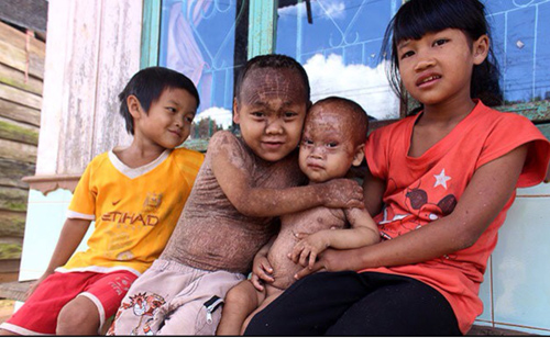 2014: 6 căn bệnh kỳ lạ nhất Việt Nam - Ảnh 5