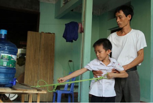 2014: 6 căn bệnh kỳ lạ nhất Việt Nam - Ảnh 6
