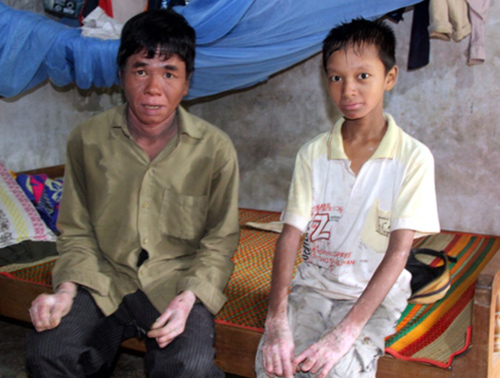 2014: 6 căn bệnh kỳ lạ nhất Việt Nam - Ảnh 7