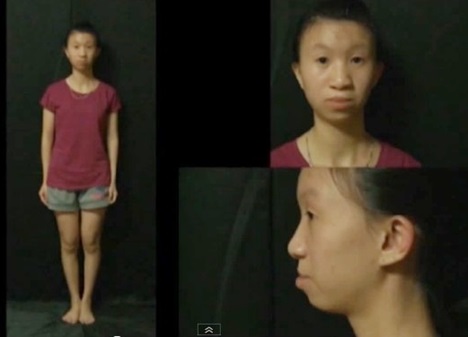 Các cô gái Việt “hoá thiên nga” sau phẫu thuật thẩm mỹ - Ảnh 11