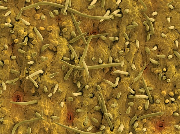 Hình ảnh chi tiết bề mặt của một trái đào. Phần da trái đào có kết cấu từ hàng ngàn sợi lông, phần lớn trong số đó rất ngắn. Những 