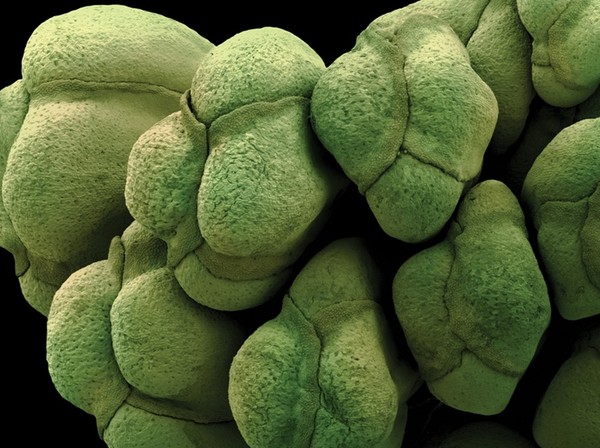 Bông cải xanh chứa nhiều Sulforaphane - chất có khả năng hoạt hóa những gene và enzyme chống oxy hóa trong tế bào miễn dịch. Những lỗ nhỏ bạn có thể nhìn thấy trên bề mặt chính là phần lỗ khí của bề mặt bông cải