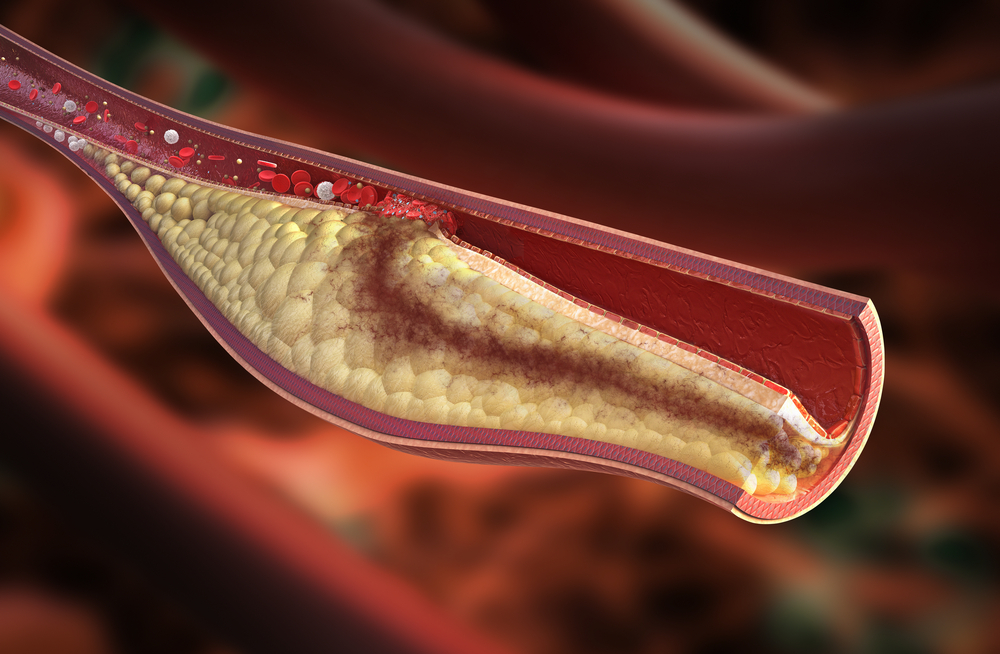 10 thực phẩm có hàm lượng cholesterol cao bạn cần tránh  - Ảnh 1