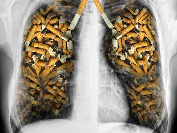 10 cách đơn giản giúp làm sạch phổi cho người hút thuốc - Ảnh 1