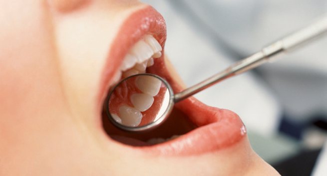 7 loại thực phẩm giúp ngăn ngừa chảy máu chân răng - Ảnh 1