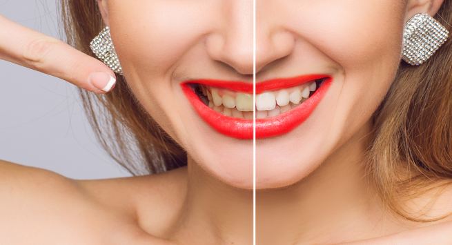 Thói quen chăm sóc răng miệng có thể khiến răng ố vàng - Ảnh 1
