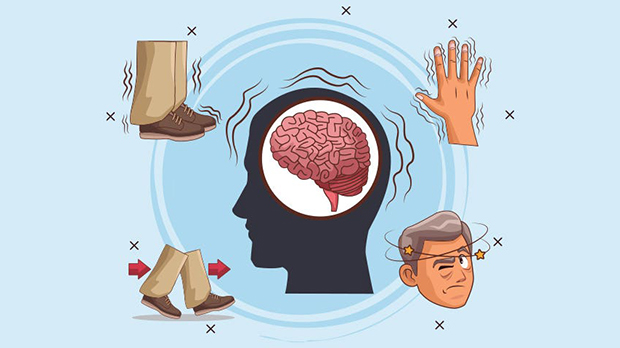 Các triệu chứng cảnh báo Parkinson đã được khoa học chứng minh - Ảnh 1