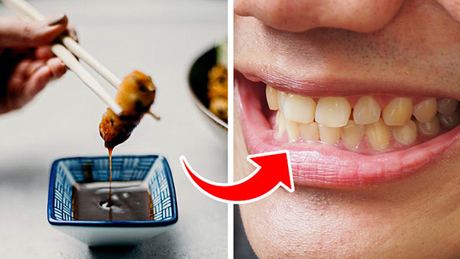 7 thực phẩm gây ố vàng răng bạn nên tránh - Ảnh 1